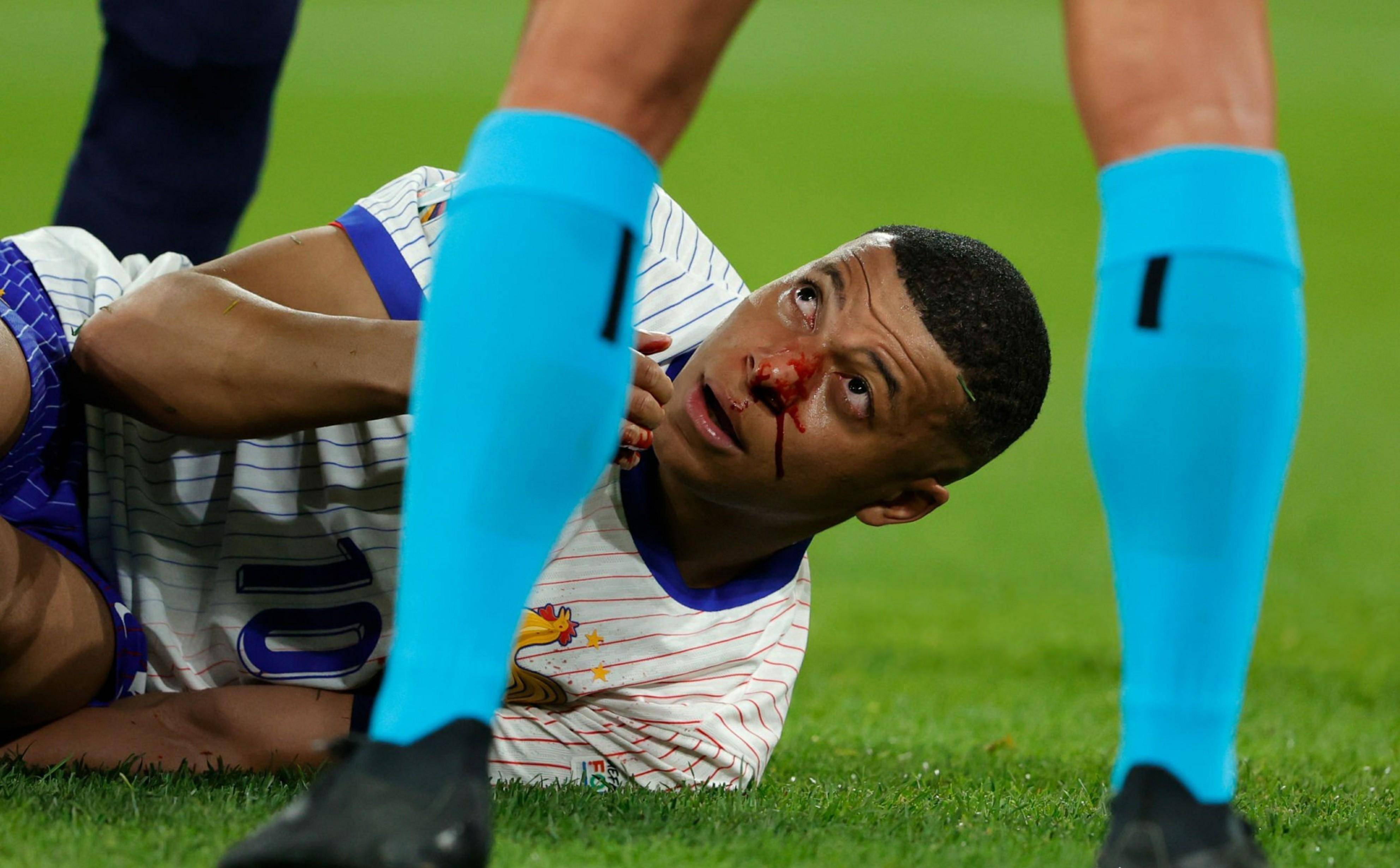 阿森纳碾压巴西，姆巴佩高光表现